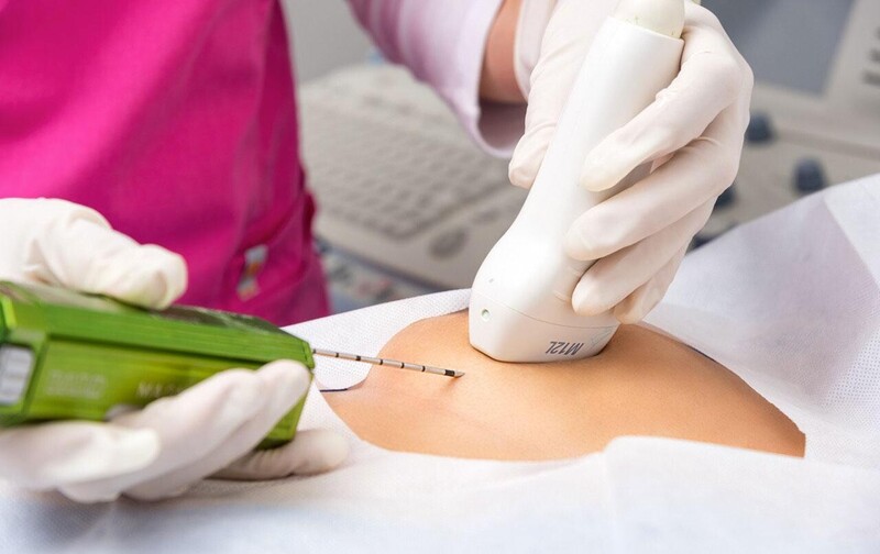 Biópsias percutâneas guiadas por ultrassom